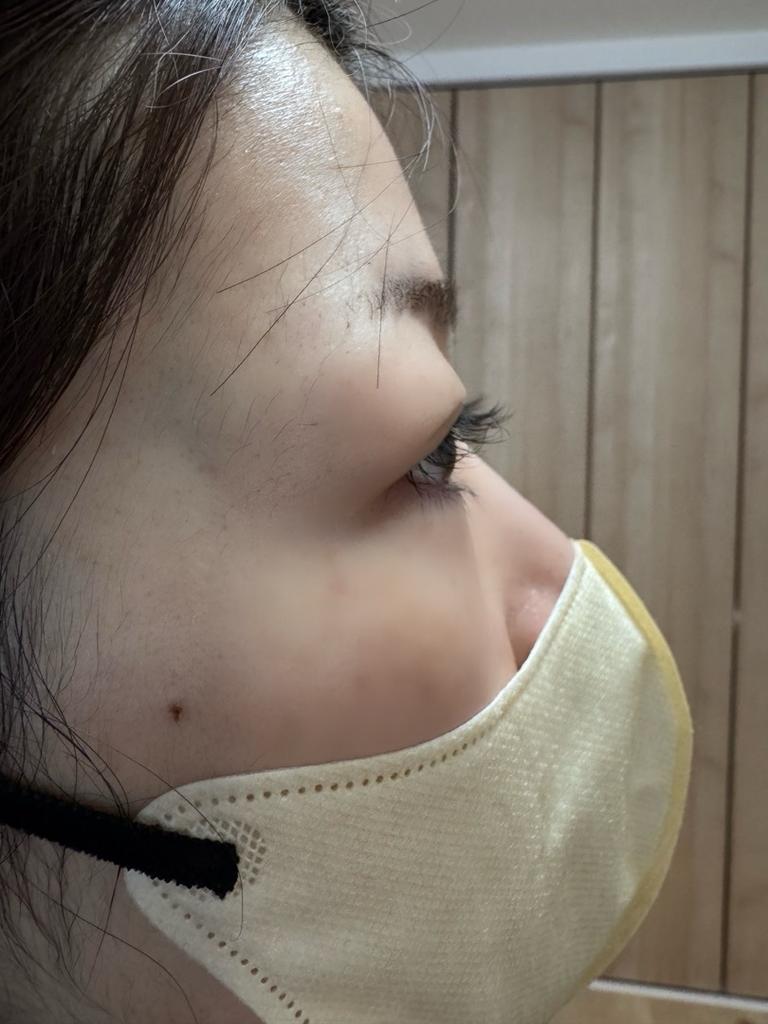 Before ラッシュリフト