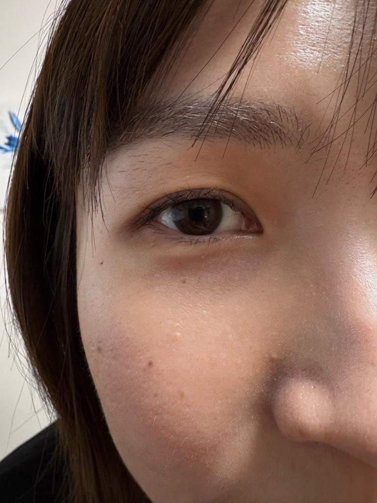 Before ラッシュリフト