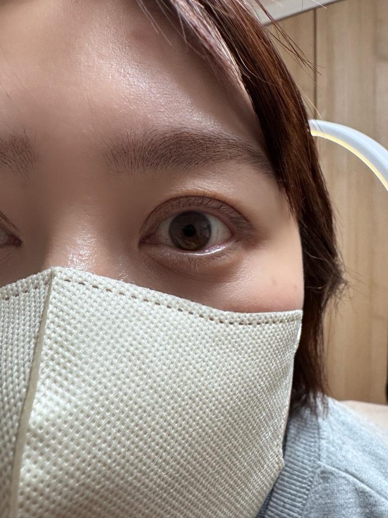 Before ラッシュリフト