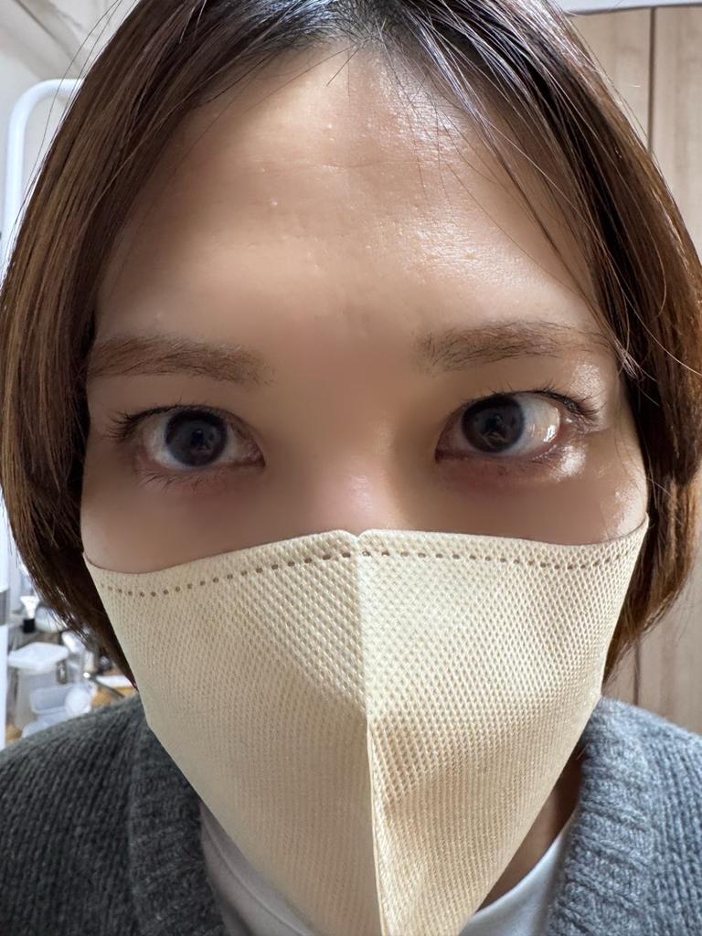 Before ラッシュリフト